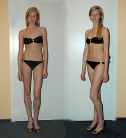 Aida Aniulyte #185094